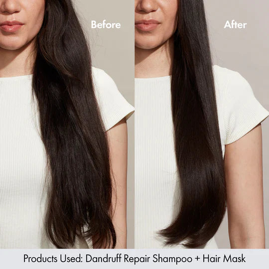 Bondi Boost Dandruff Hair Mask - AtsiHairSupplies