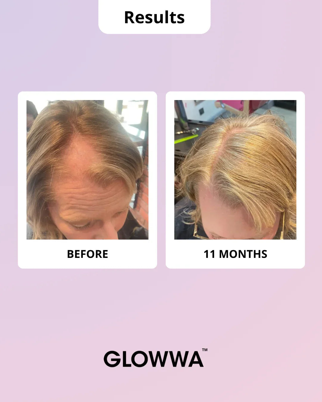 GLOWWA HAIR FOOD | MENO - Hair Vitamins 60 Capsules - AtsiHairSupplies
