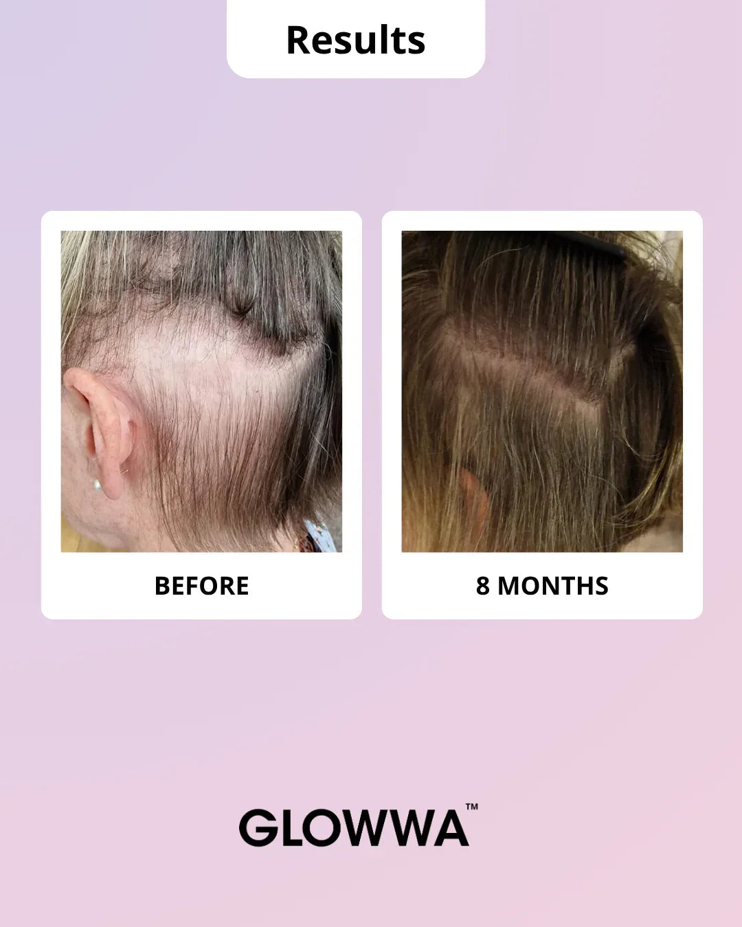 GLOWWA HAIR FOOD | MENO - Hair Vitamins 60 Capsules - AtsiHairSupplies