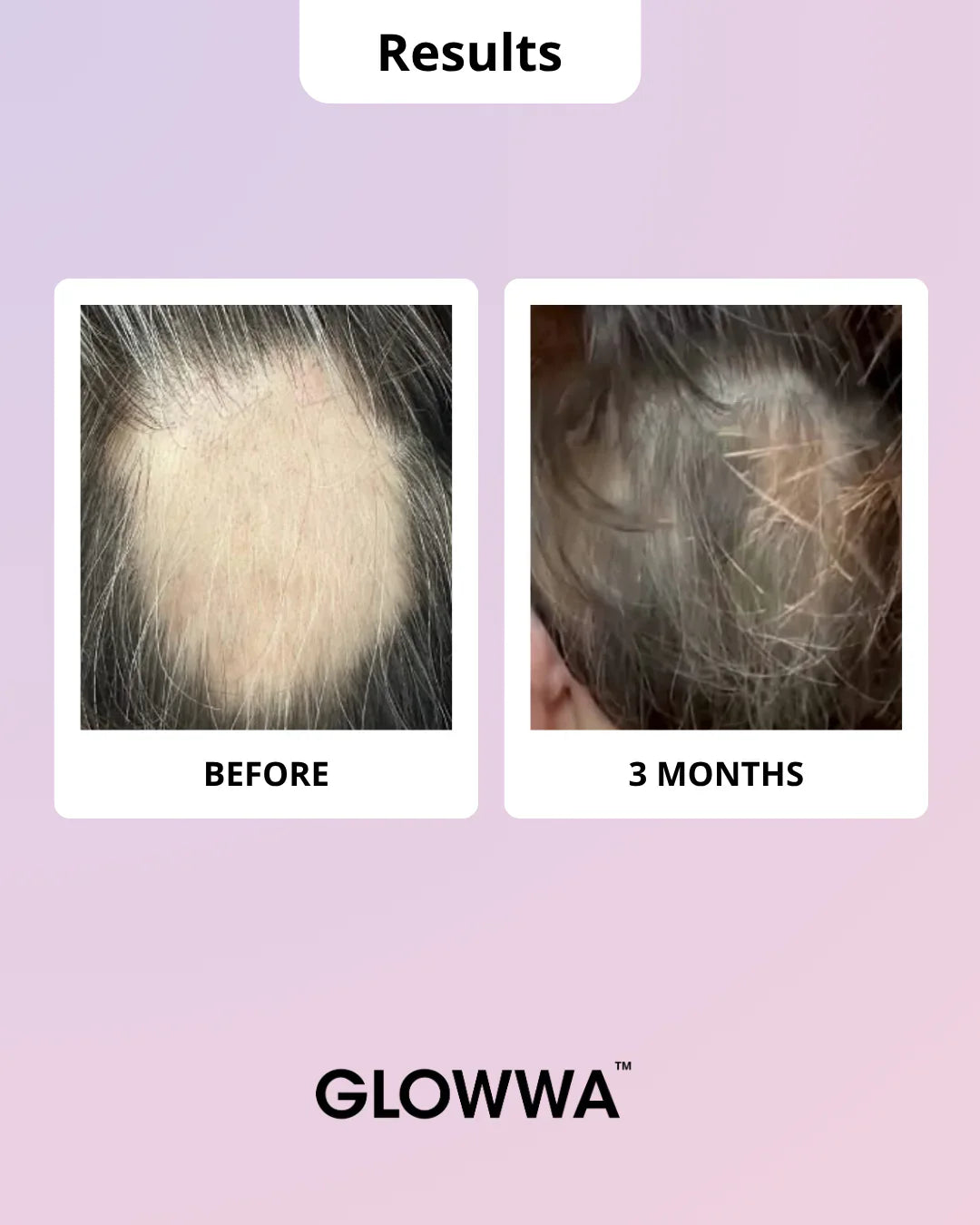 GLOWWA HAIR FOOD | MENO - Hair Vitamins 60 Capsules - AtsiHairSupplies