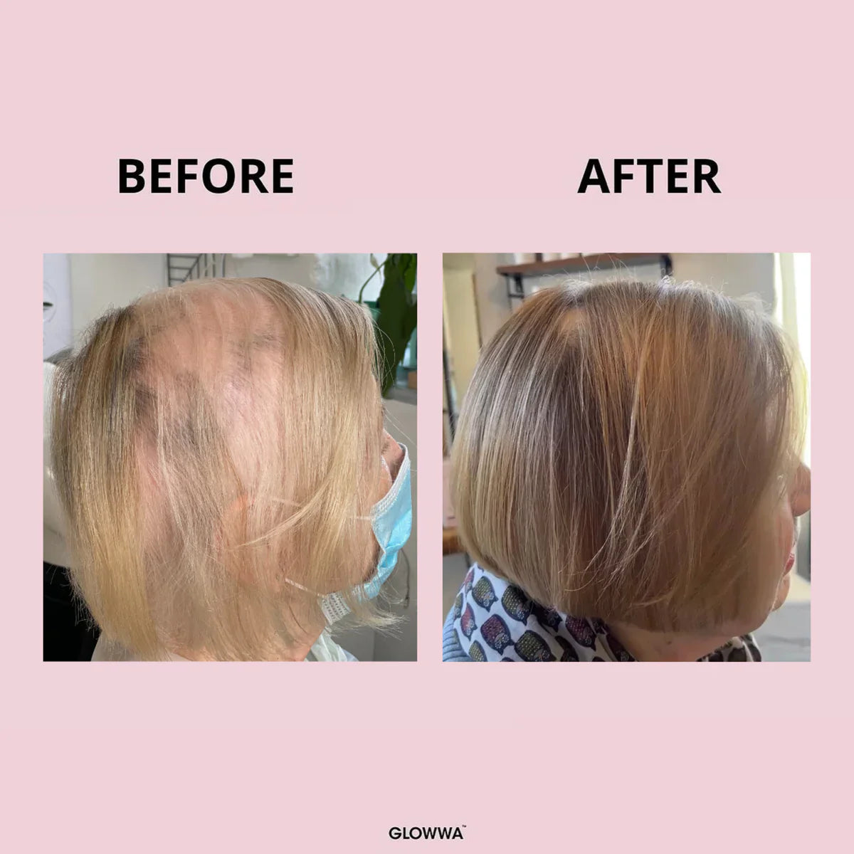 GLOWWA HAIR FOOD - 3 Month Supply
