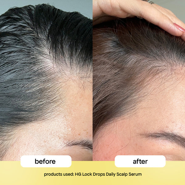 BONDI BOOST HG LOCK DROPS Anti-Shedding Scalp & Hair Serum 30ml - AtsiHairSupplies
