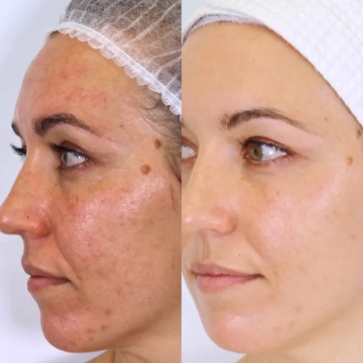 VANESSA MEGAN THE HOLY TRINITY DAILY SKIN CARE ROUTINE (FULL) - AtsiHairSupplies