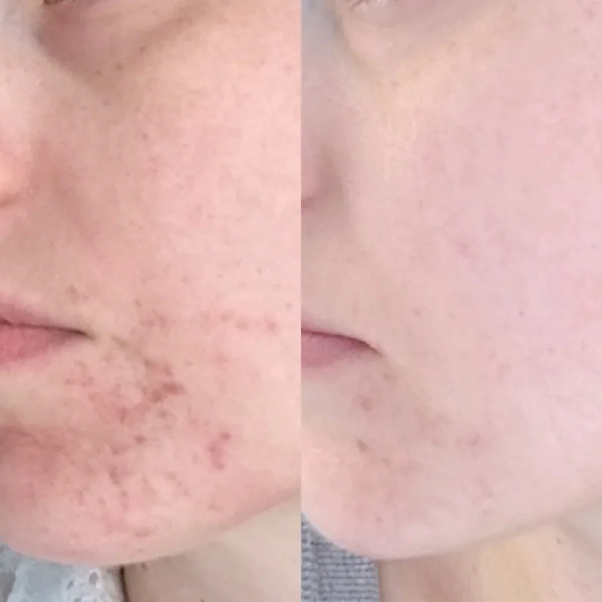 VANESSA MEGAN THE HOLY TRINITY DAILY SKIN CARE ROUTINE (FULL) - AtsiHairSupplies